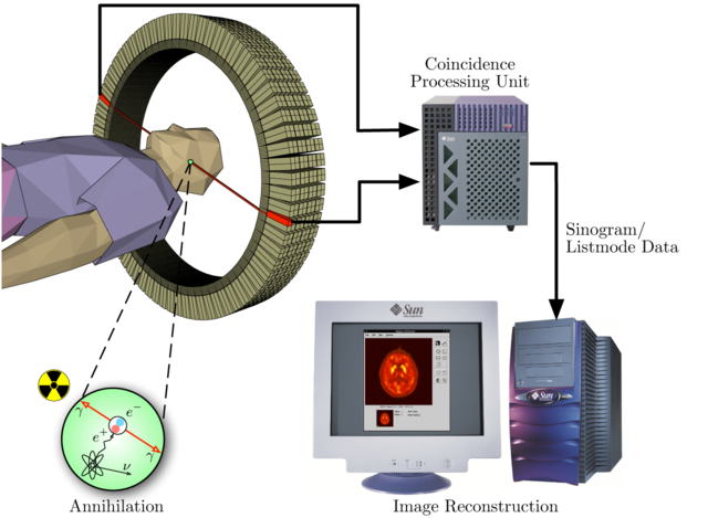 How PET microchip work