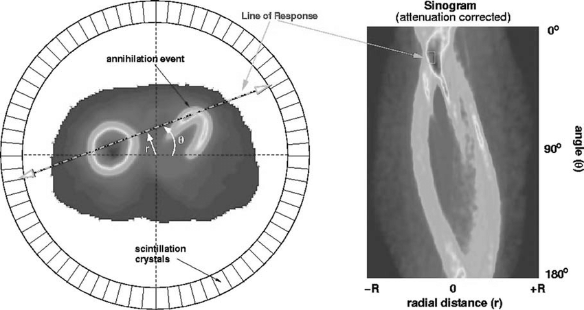 how PET microchip work: transforming signal into image